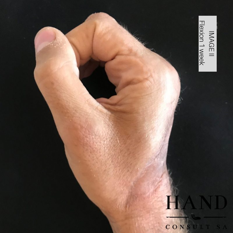 Theun's Journey: Results after 1 week of CMMS