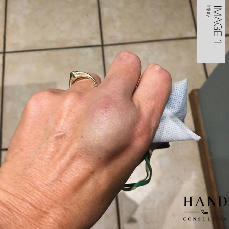 How a small incident can cause a lot of damage.
