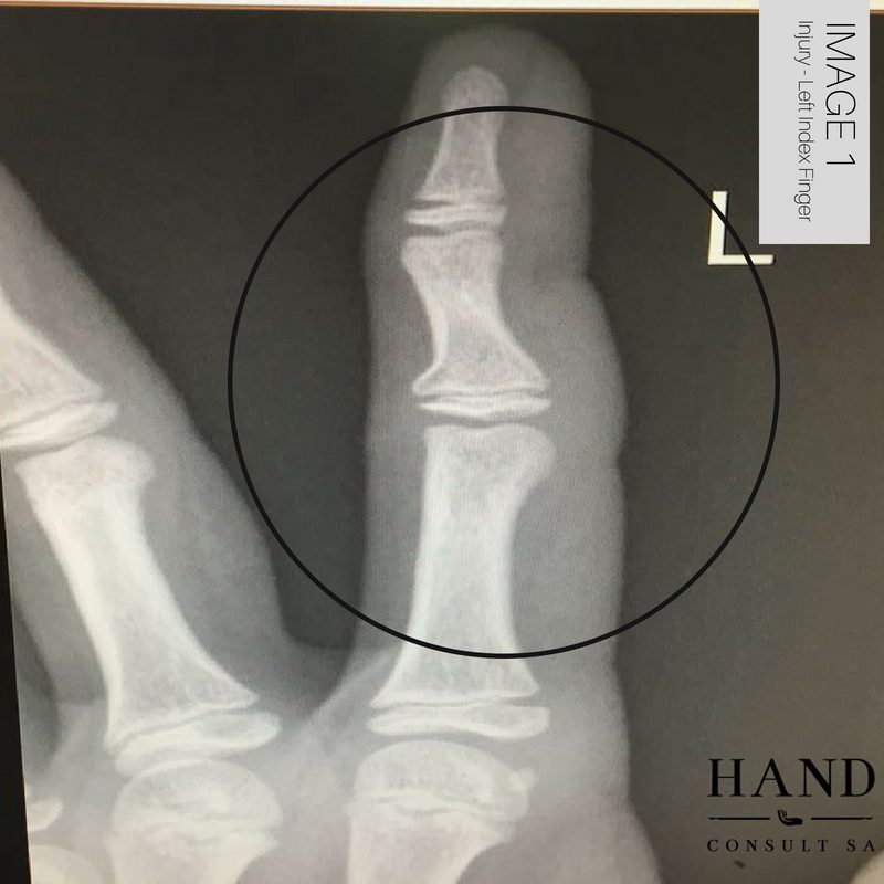 Rugby Injury