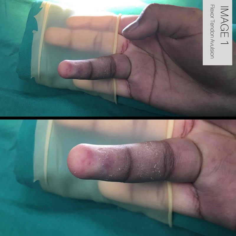 Rugby Jersey Finger